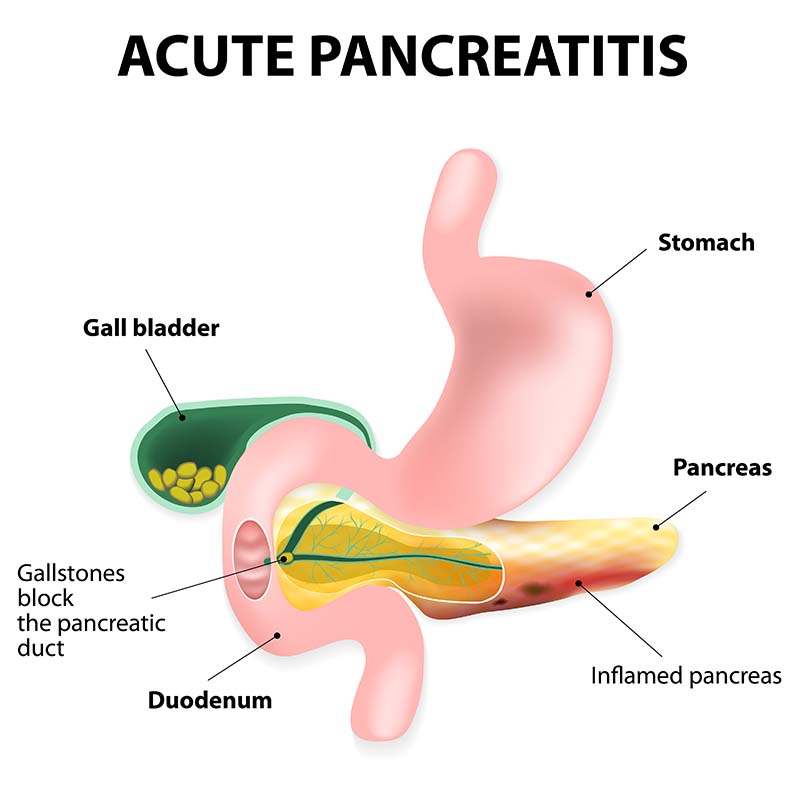 Acute Pancreatitis bij Honden